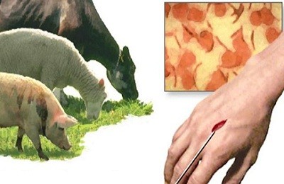 Заражение коров и свиней сибирской язвой и ее лечение
